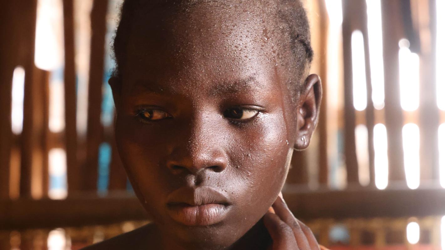 Girl in Mangatheen IDP camp